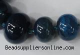 CAG5425 8*12mm – 20*30mm rondelle dragon veins agate beads