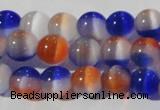 CCT1340 15 inches 6mm round cats eye beads wholesale