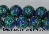 CTU1817 15.5 inches 16mm round synthetic turquoise beads