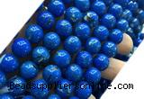 CTU3157 15 inches 12mm round gold vein howlite turquoise beads